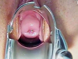 Sara Gyno Pussy Speculum Exam By Kinky Old Doctor Porn 0e