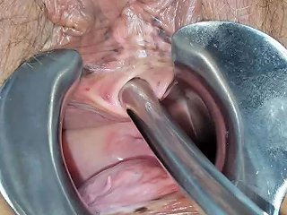 Peehole And Speculum Play Free Free Speculum Hd Porn 67